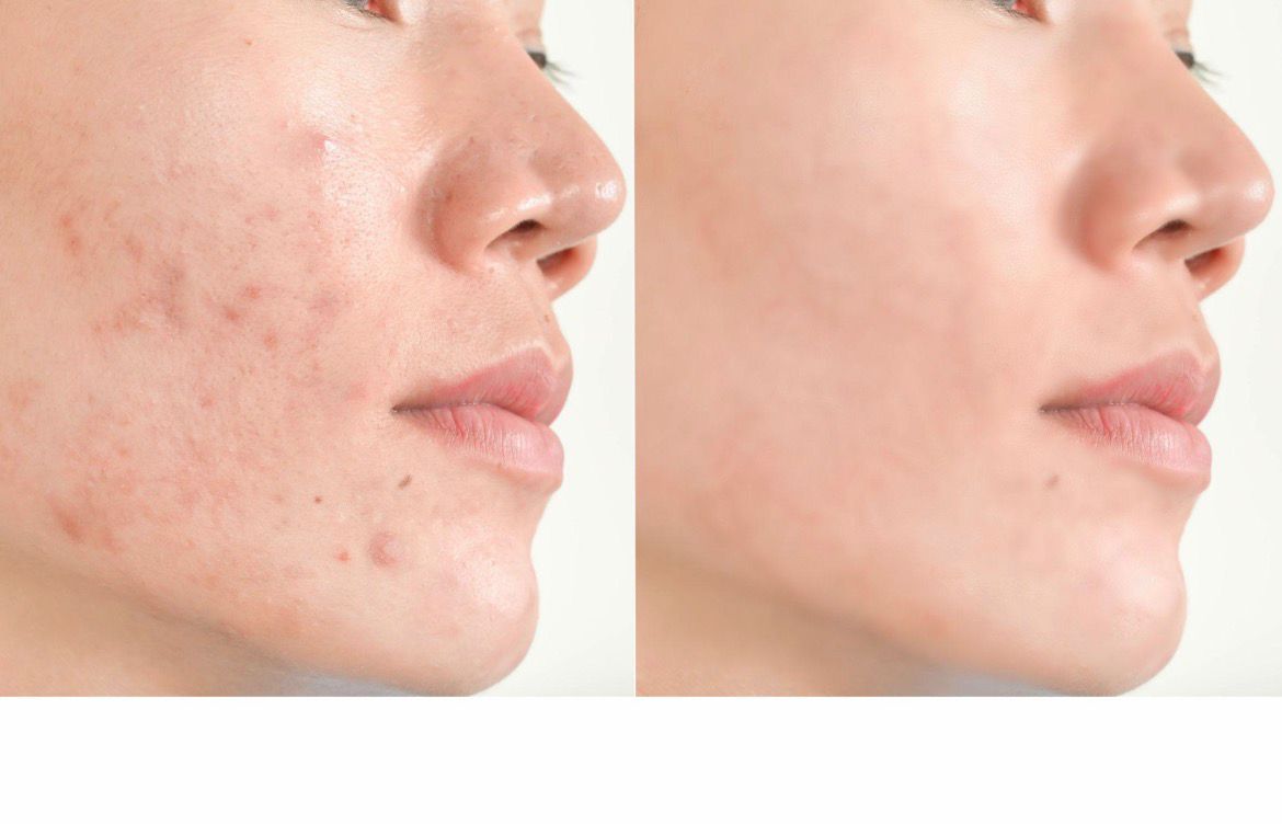 Dark Spot Corrector Cream