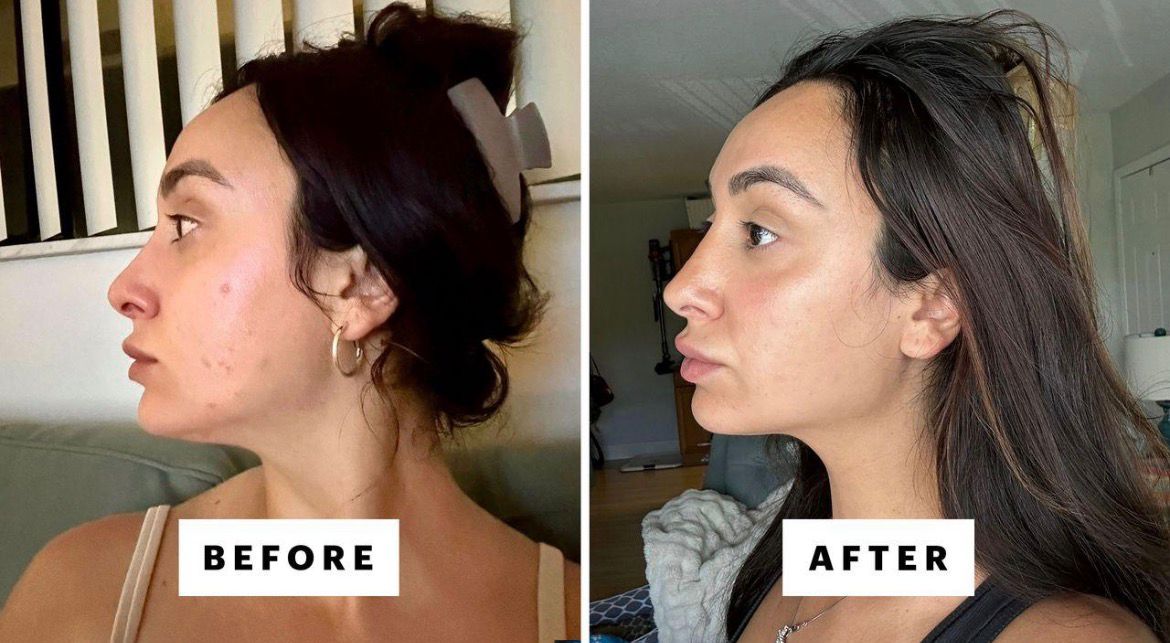 Dark Spot Corrector Cream